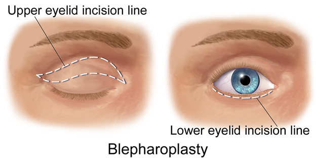 Finding the Best Eye Specialist in Dubai: A Comprehensive Guide for Optimal Eye Care